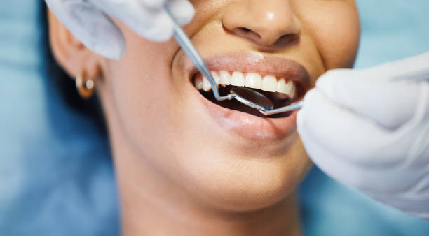 Best Broken or Chipped Tooth Repair in Hot Springs Village, AR